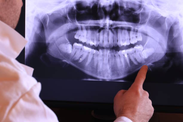 Best Mobile Emergency Dentist in Corrigan, TX